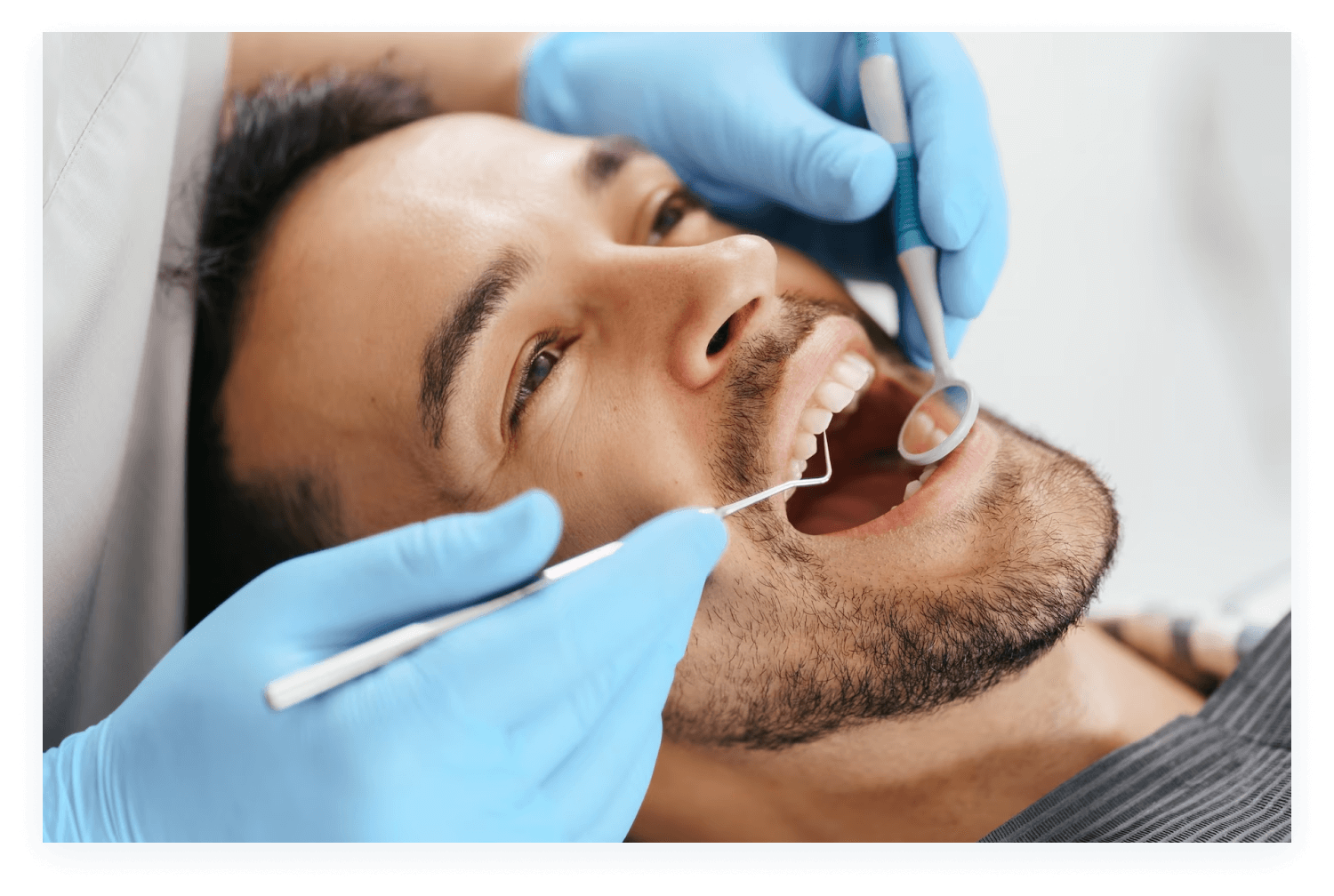 Qué es el Blanqueamiento Dental
