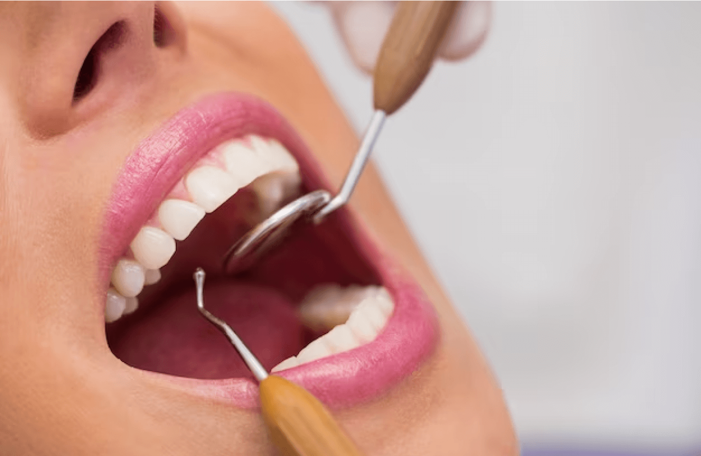 La Importancia de una Buena Estética Dental