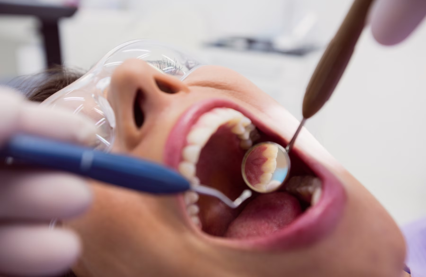 Profundizando en la Cirugía Dental-2